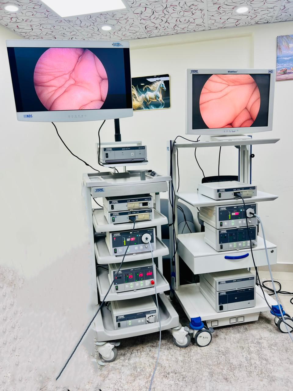 Karl Storz Endoscopy Tower System