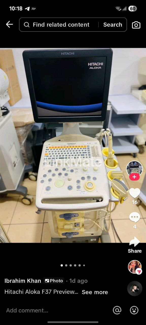 Hitachi Aloka F37 ultrasound